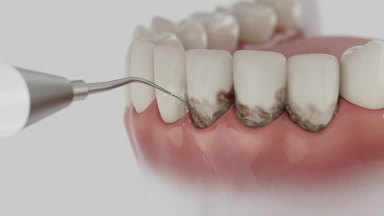 Trusted Teeth Cleaning And Checkup service in Richland, WA - Dentist Open Now